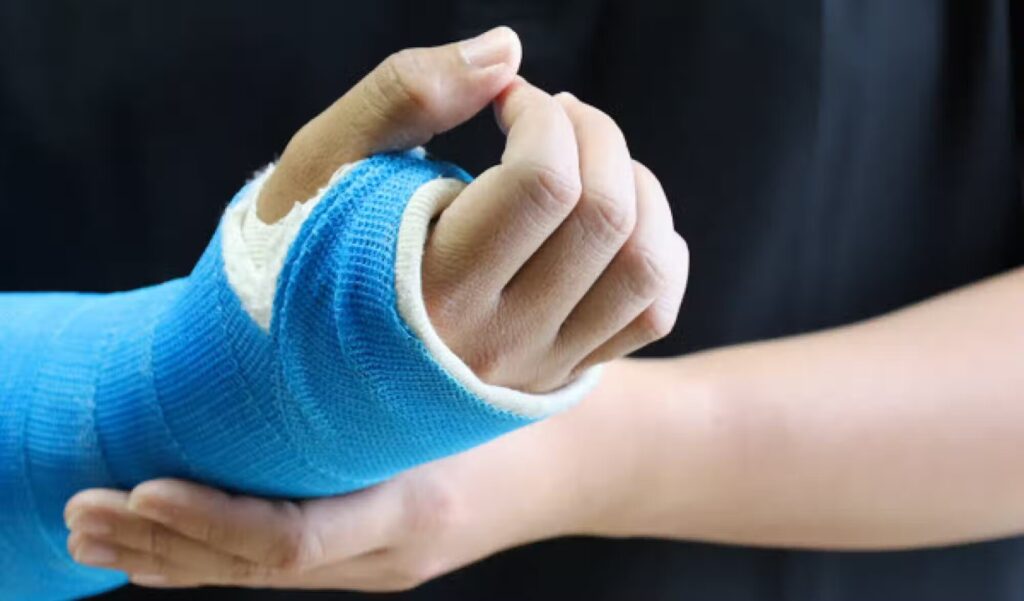Studenten ontwerpen ‘dummy arm’ voor het testen van gips | Quest